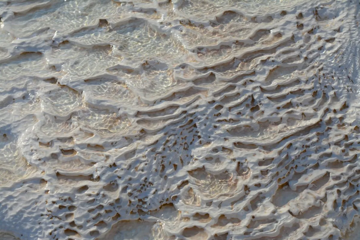 Shoulder imaging showing calcific deposits in the rotator cuff