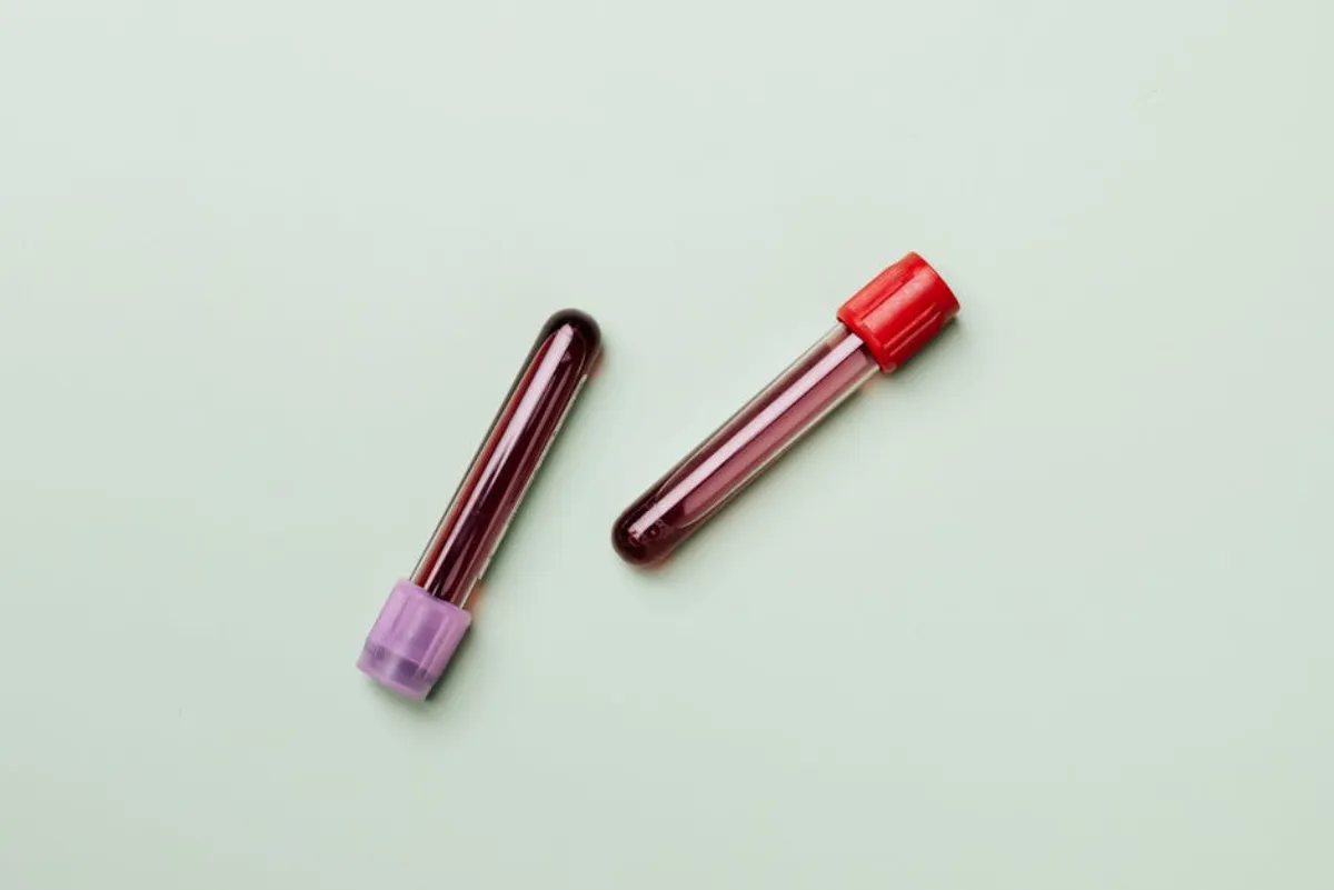 PRP blood draw compared to shockwave therapy treatment